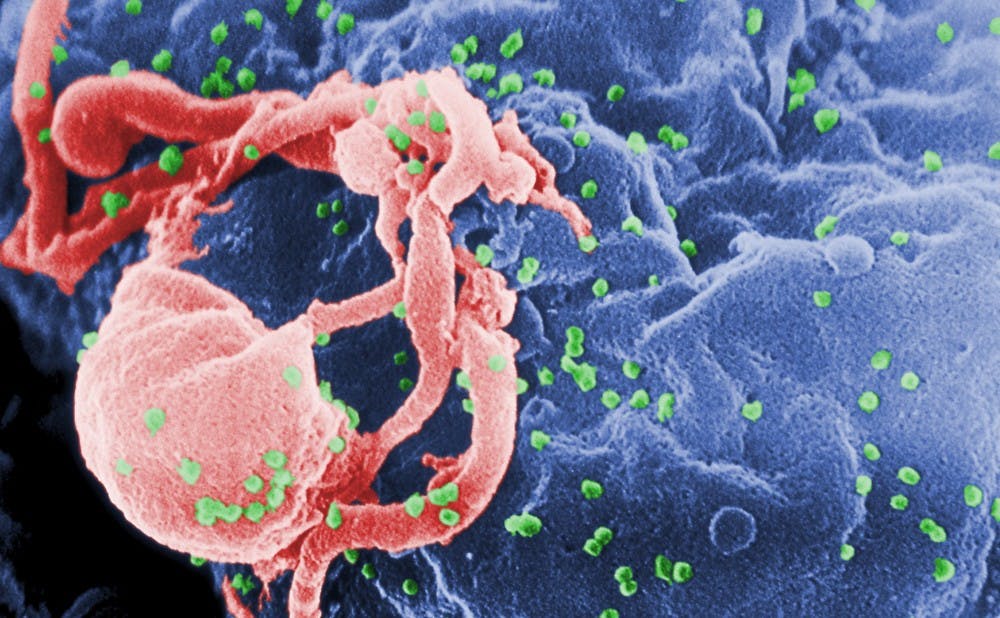 HIV-budding-Color-2