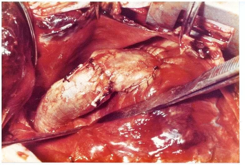 B9_Tissue