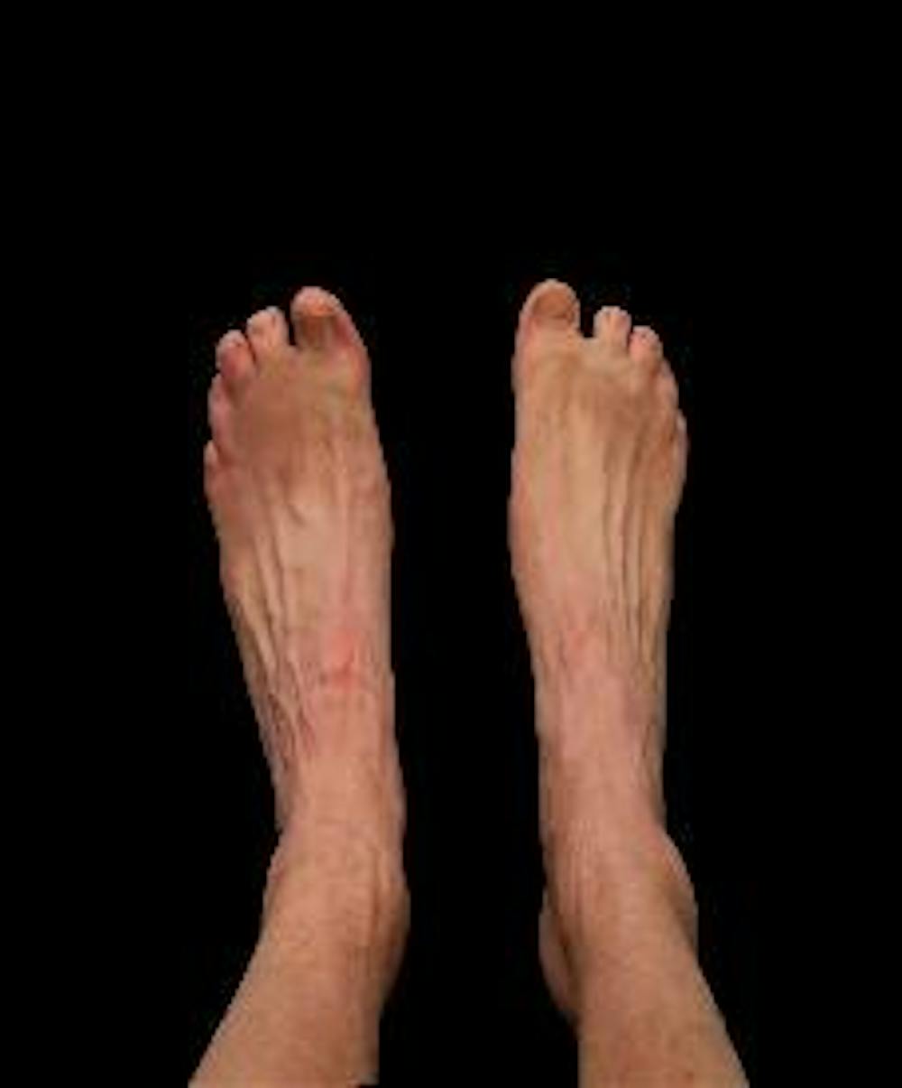 PLAYIN' FOOTSIE - You know what they say about big feet ... big swim wins! Fout proved it was possible with his size 36 feet yesterday. 