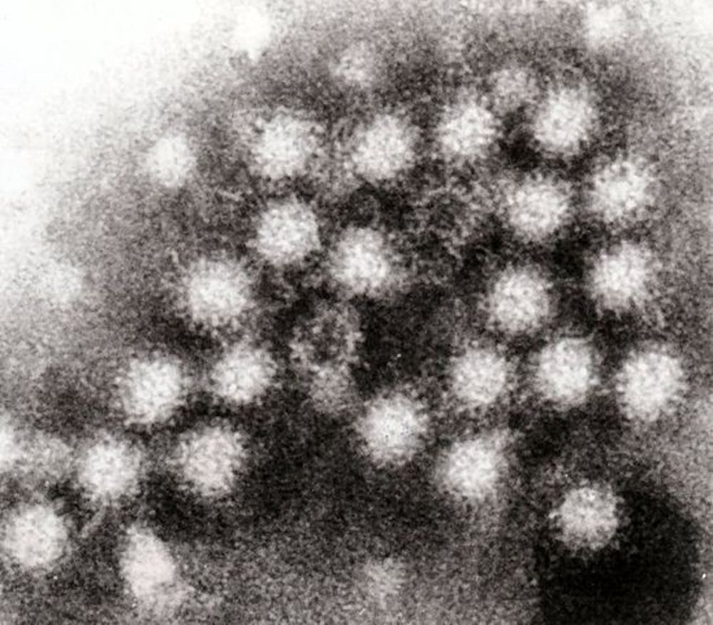 The Norovirus.