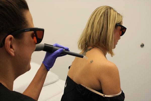 Holly Rennett, a registered nurse, begins treatment to remove a star tattoo on Tricia Corley's shoulder at Mill Avenue's Dr. TATTOFF on Nov. 15. (Photo by Jessie Wardarski)