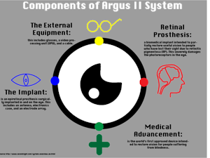 The Argus II System can be described&nbsp;through four main&nbsp;components including: the external equipment, the implant, retinal prosthesis, and the&nbsp;medical advancement of the device itself.&nbsp;