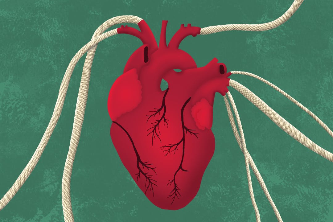 SciTech-3D-Printed-Vascular-Graft
