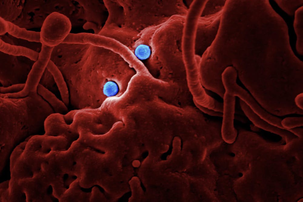 <p>Produced by the National Institute of Allergy and Infectious Diseases (NIAID), in collaboration with Colorado State University, this highly magnified, digitally colorized scanning electron microscopic (SEM) image, reveals ultrastructural details at the site of interaction of two spherical shaped, Middle East respiratory syndrome coronavirus (MERS-CoV) viral particles, colorized blue, that were on the surface of a camel epithelial cell, colorized red.<br>
</p>