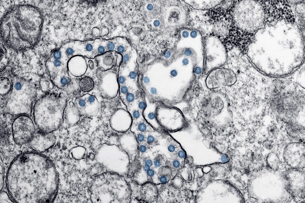 Transmission electron microscopic image of an isolate from the first U.S. case of COVID-19, formerly known as 2019-nCoV. The spherical viral particles, colorized blue, contain cross-section through the viral genome, seen as black dots.