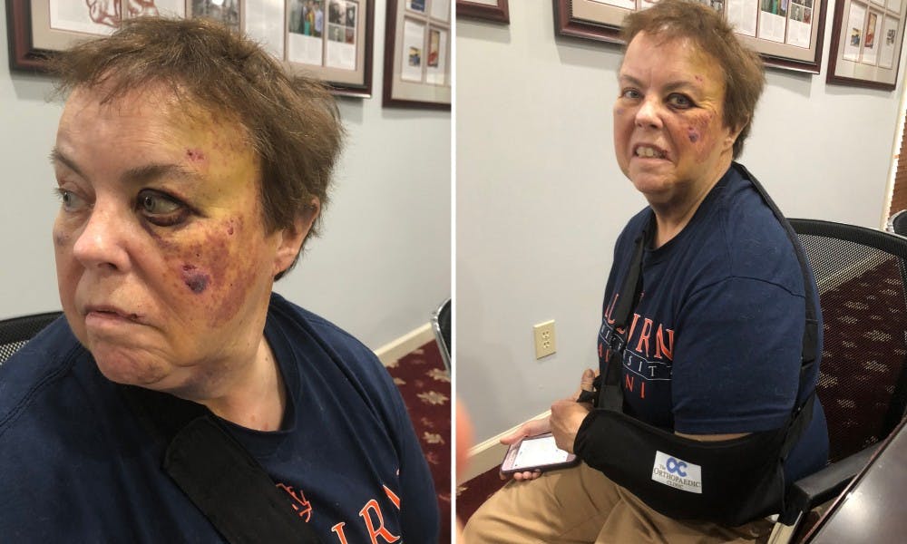 <p>An Auburn student, 20-year-old Jess Erwin Ralston, from Auburn, has been charged with third-degree assault, police said, after attacking a 58-year-old female Lyft driver, Lennie Hartzog (above), in the 200 block of West Longleaf Drive. (via Trip Watson)</p>