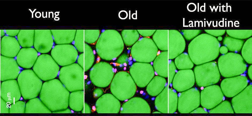 Sagaityte_HIV-AIDS-Drug_CO_Brown-University