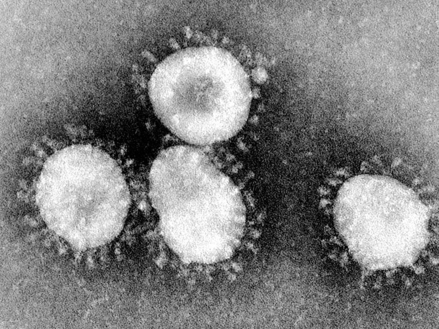 iBrahim_Coronavirus-Outbreak-Update_CO_CDC