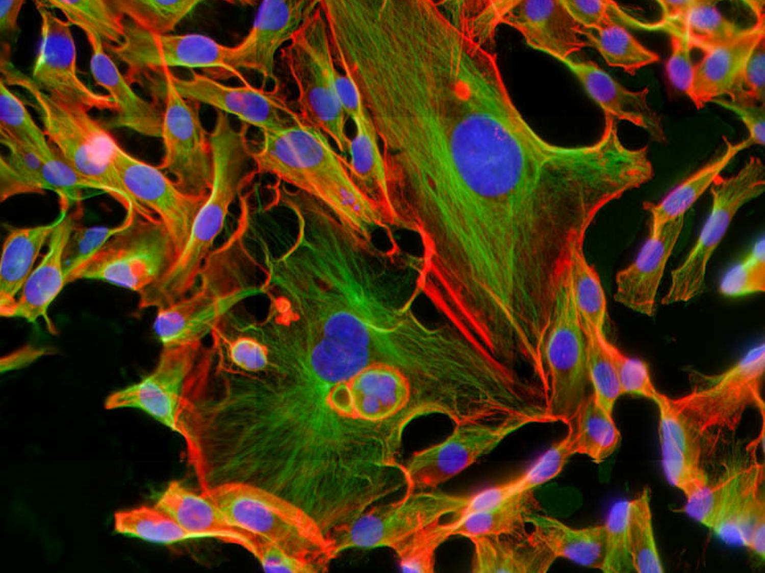 Hrabarchuk_Cancer-Cell-Research_CO_Michelle-Dawson