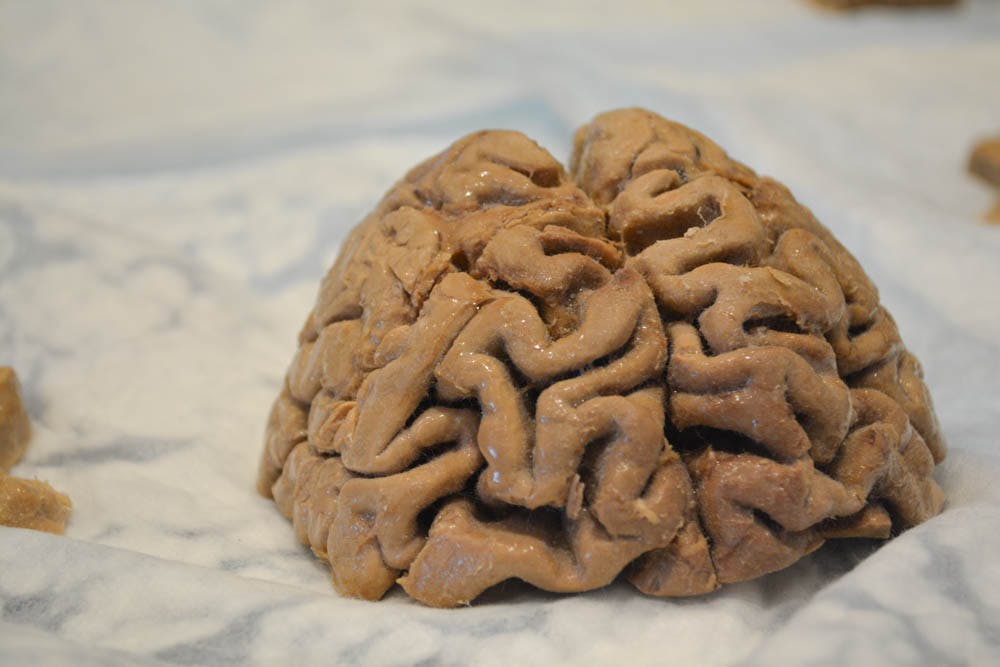 Ganga_Brain-Week-RI_Kaitlyn-Lew