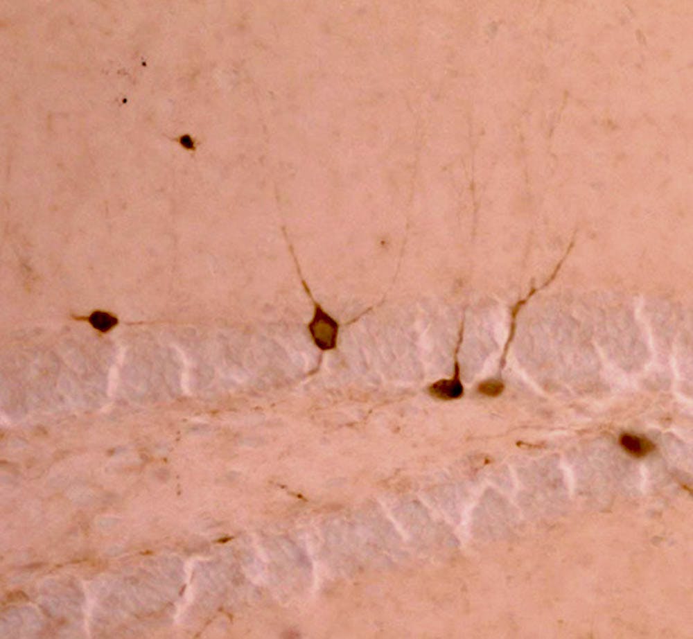 Chang_Childhood-Stressors_Janet-Chang