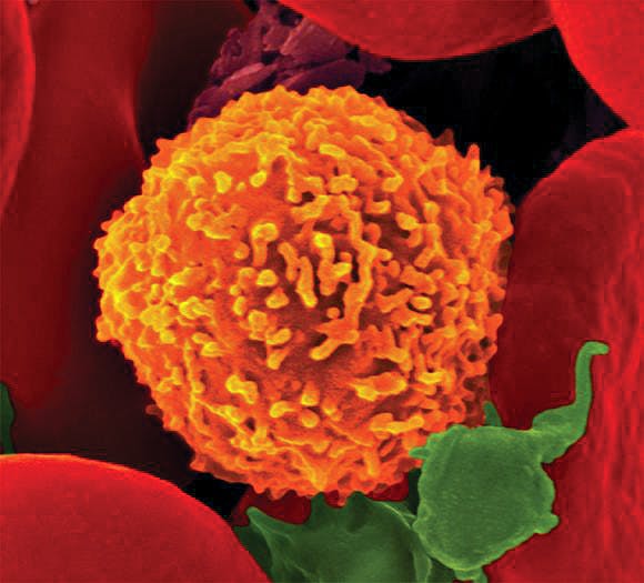 Talerico_Immune_CODennis-Kunkel-Microscopy