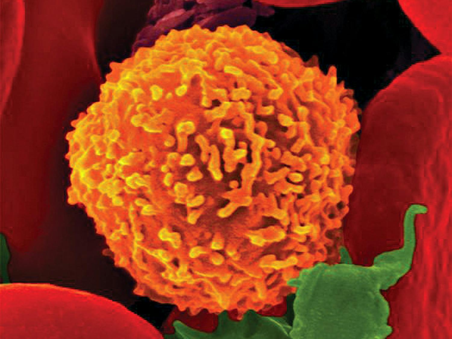 Talerico_Immune_CODennis-Kunkel-Microscopy