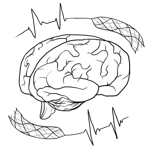 strokestent-by-Dorothy-Windham