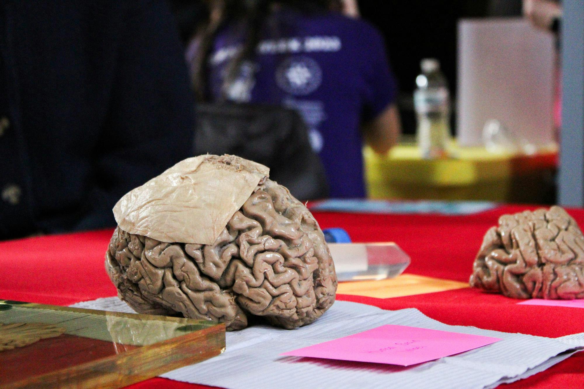 A photo of a human brain covered in a piece of plastic sitting on a piece of paper with a pink index card in front of it. 