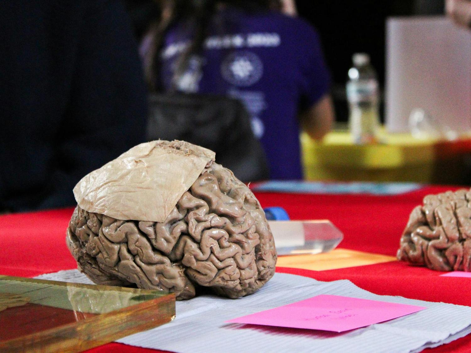 A photo of a human brain covered in a piece of plastic sitting on a piece of paper with a pink index card in front of it.