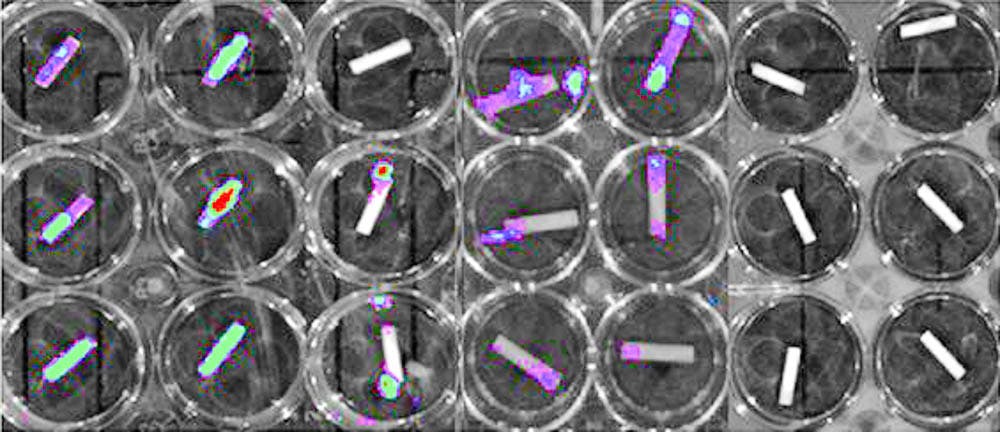 Germ_Fighting_Catheter_Coating_CO_Brown_Press_Release