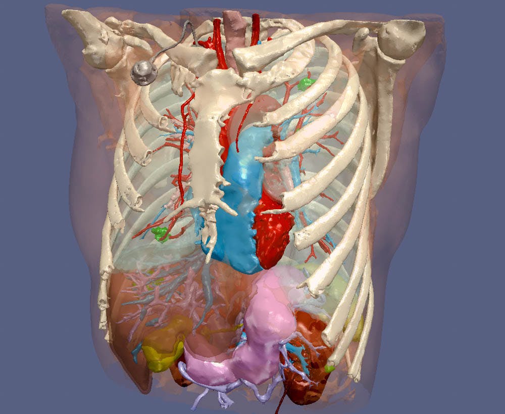 Courtesy-of-Scott-Collins_v3D_Courtesy-of-Scott-Collins