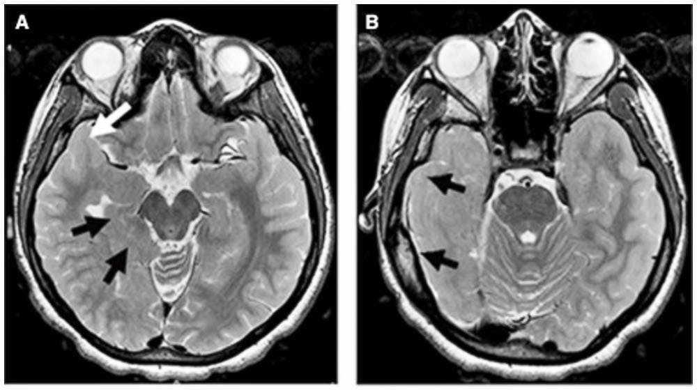 Pattillo_ClockProtein_COBrown-2
