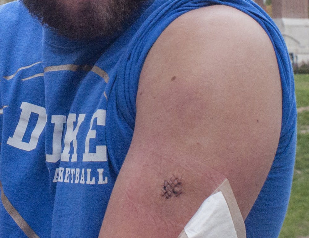 Andrew Pizzano shows his wound on Oct. 29. Pizzano said someone stabbed him on Oct. 26. This is the second time Ball State has accused students of false reports in four years. DN FILE PHOTO ADAM BAUMGARTNER