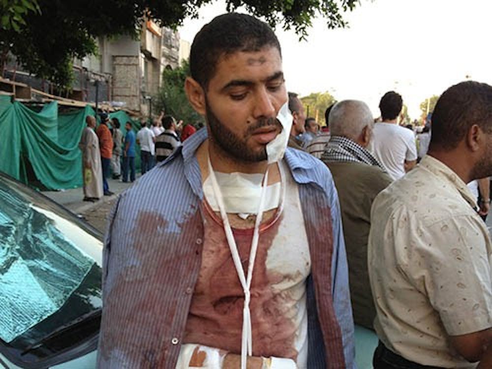 Walid el Halali, a Ministry of Investment employee, was among those injured in clashes with Republican Guards in Cairo on Friday. The conflict erupted over groups being unsatisfied with the country’s new leadership. MCT PHOTO