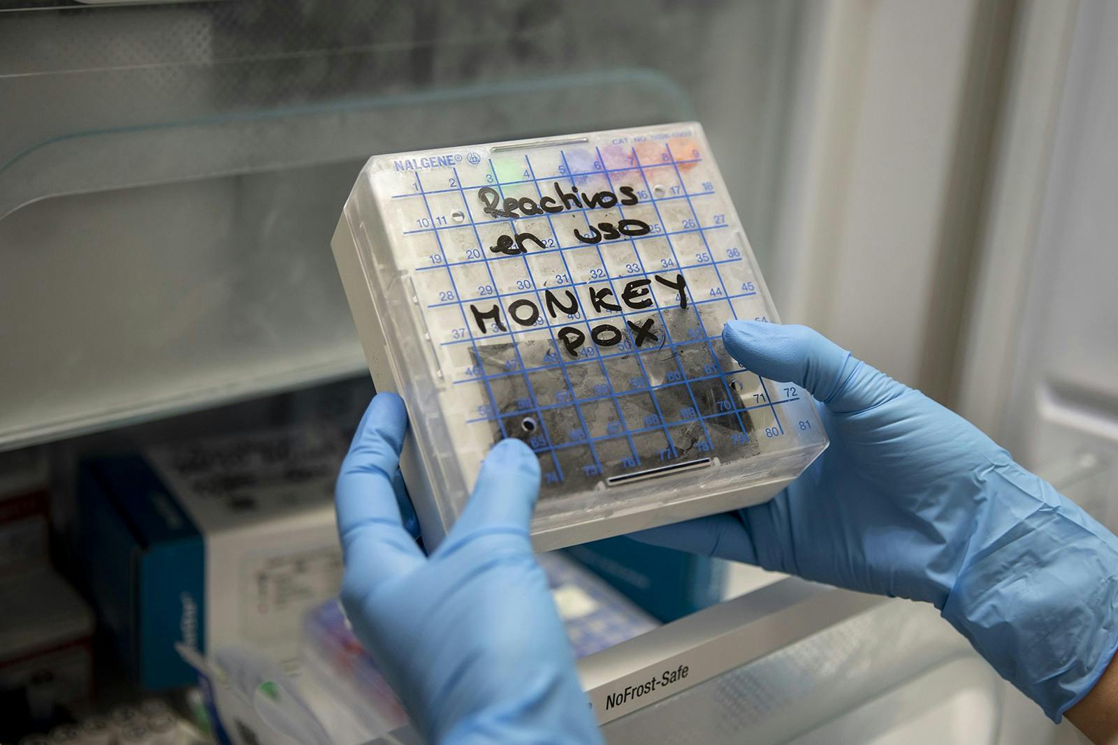 A medical laboratory technician picks up from a fridge a reactive to test suspected monkeypox samples at the microbiology laboratory of La Paz Hospital on June 6, 2022, in Madrid, Spain. (Pablo Blazquez Dominguez/Getty Images/TNS)