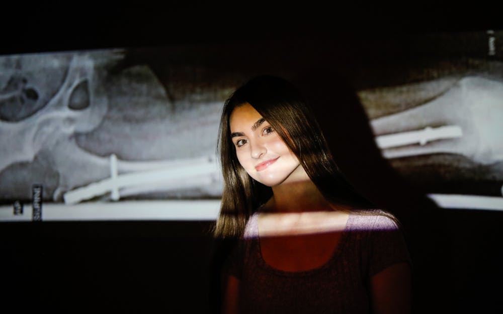 Second-year journalism major Jayden Vaughn poses with an x-ray of hers behind her Feb. 10 at the Arts and Journalism Building. Vaughn was diagnosed with bilateral femoral anteversion when she was 11 years old. Andrew Berger, DN 
