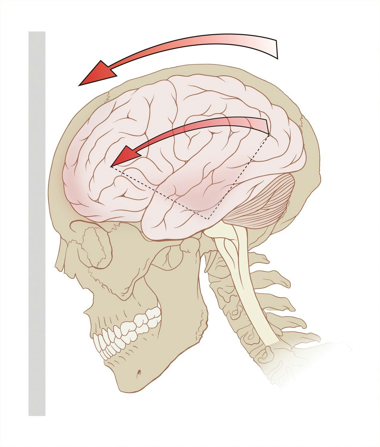 Wikimedia Commons, photo courtesy