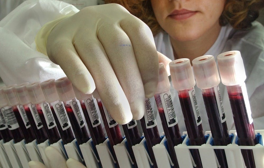 <p>Leila Kohbodi and Melvin Narciso prepare viles of blood to be screened for the West Nile Virus at the American Red Cross National Testing Laboratory in San Diego on July 20, 2004, in San Diego, CA. The samples are from donors who gave blood at a blood bank. The San Diego lab has already prepared additional testing space in case the virus spreads to an epidemic scale. TNS Photo</p>