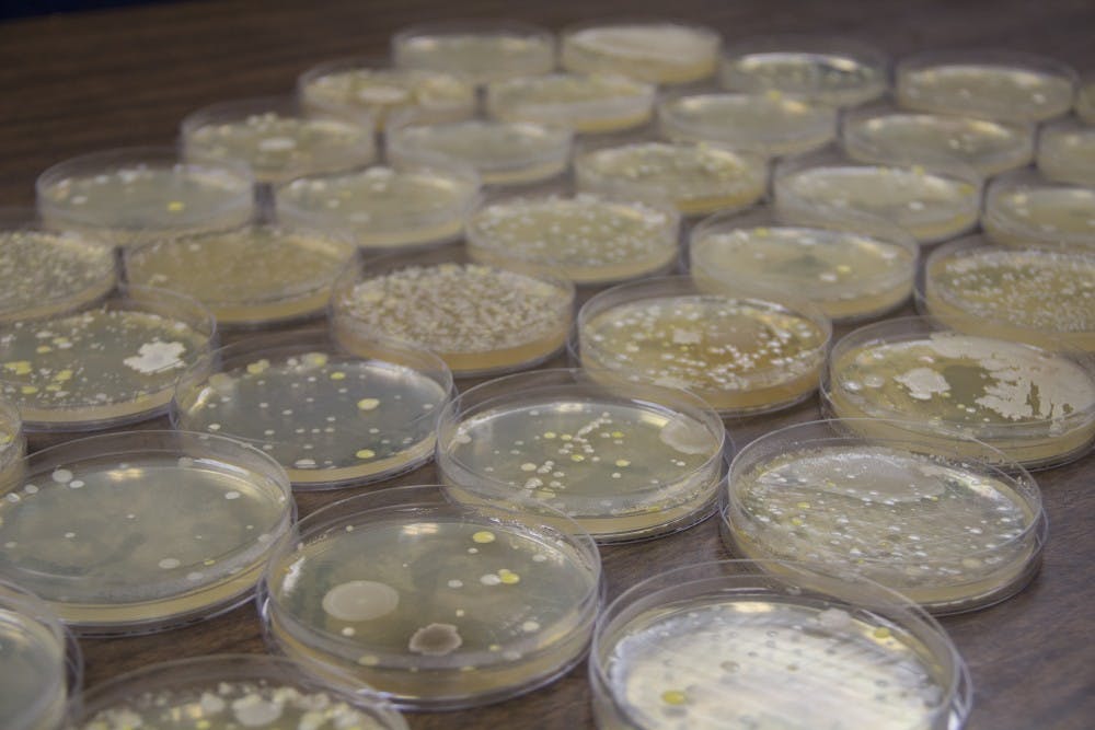 On March 7, The Spectrum swabbed 39 locations and commonly touched objects around North Campus to collect samples of microbes, which include bacteria, fungi, and mold. Samples from places like the Knox 20 table were identified as mold whereas items like a Putnam’s fork dispenser was relatively free of bacteria.