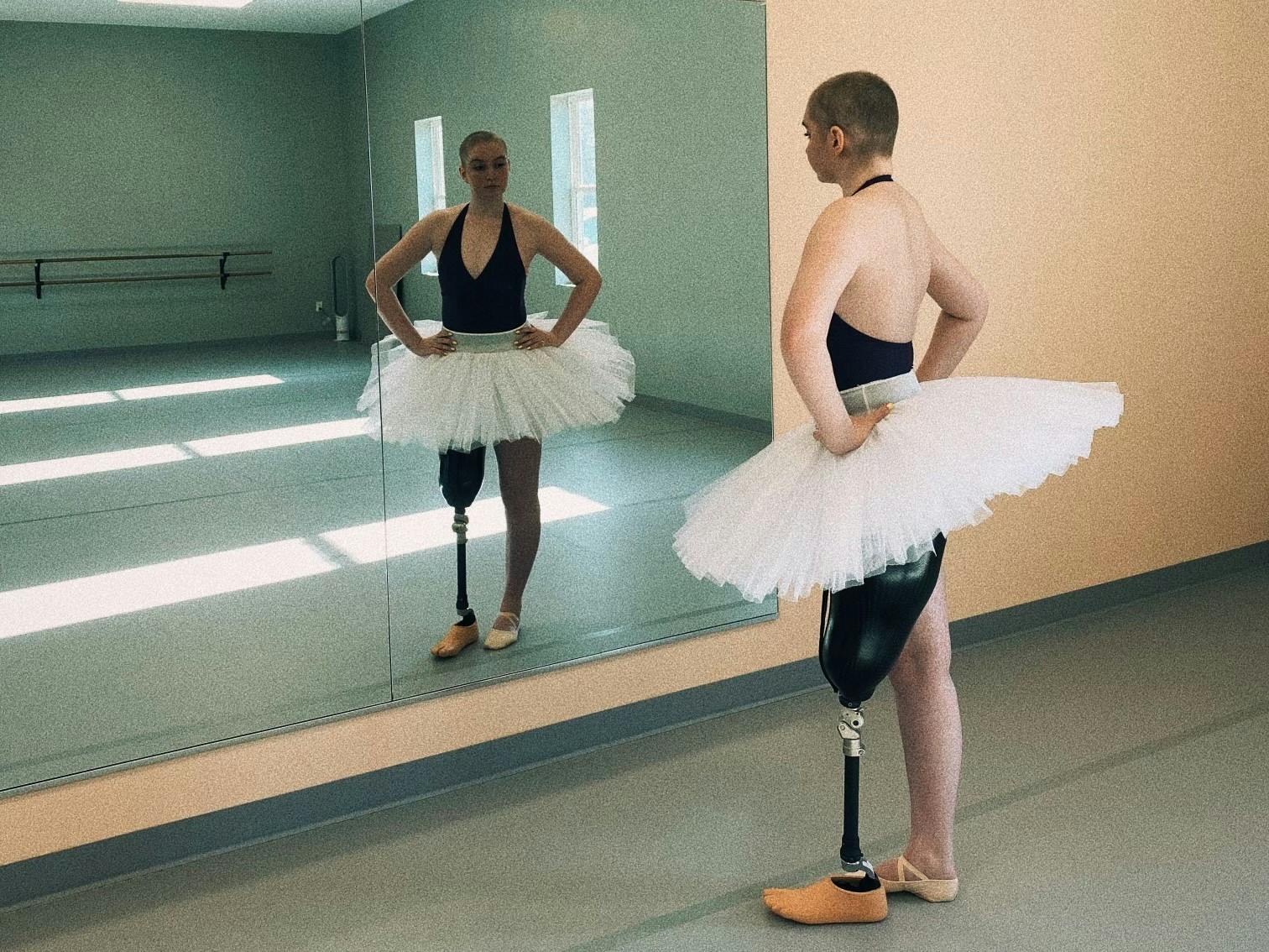 UB senior Kara Skrubis hasn’t let bone cancer nor amputation stop her from doing what she loves.&nbsp;