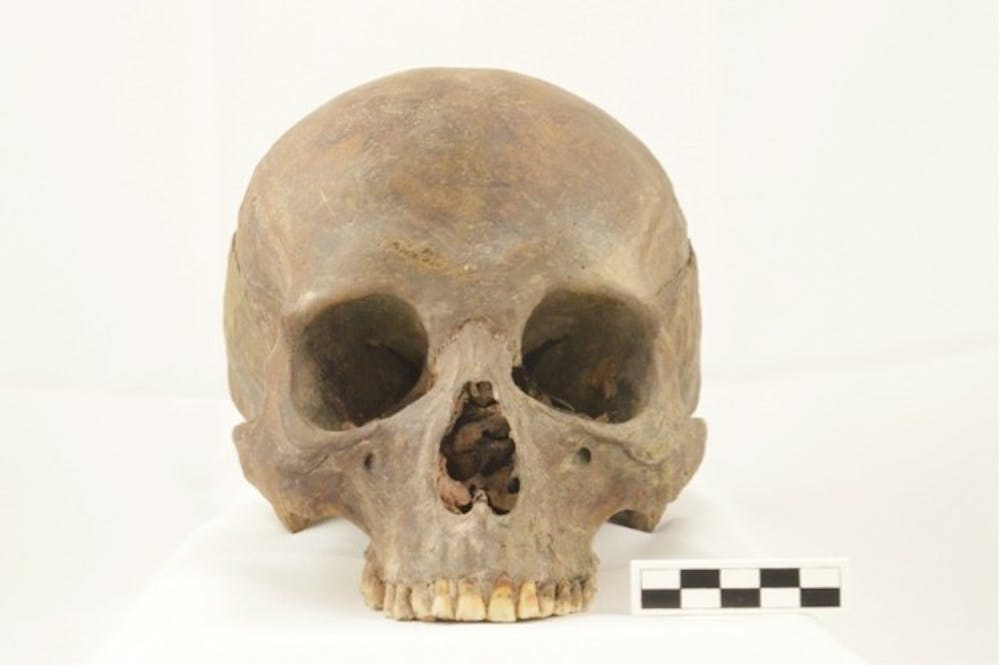 <p>A skull (pictured) recovered from the excavations done on on the former Erie County Poorhouse cemetery, which was located on South Campus before UB purchased the land.</p>