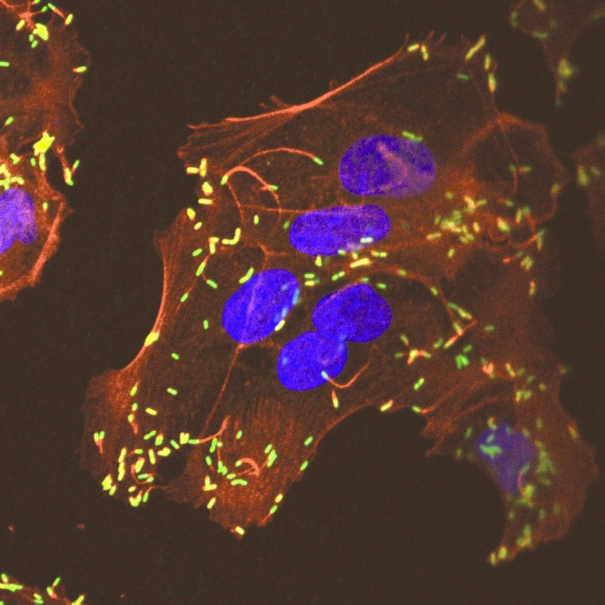 Listeria, stained green in this image, invades a monkey's uterus during the first trimester of pregnancy.