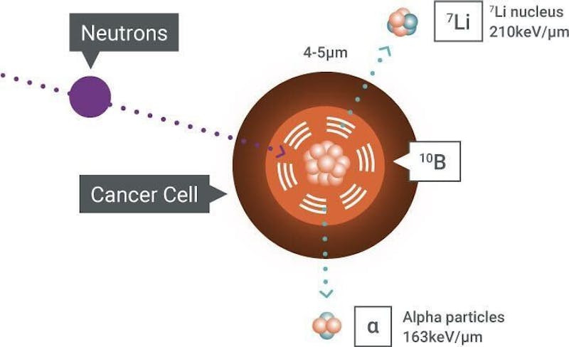 Neutron Capture Therapy makes UW-Madison ‘hotbed’ for cancer innovation