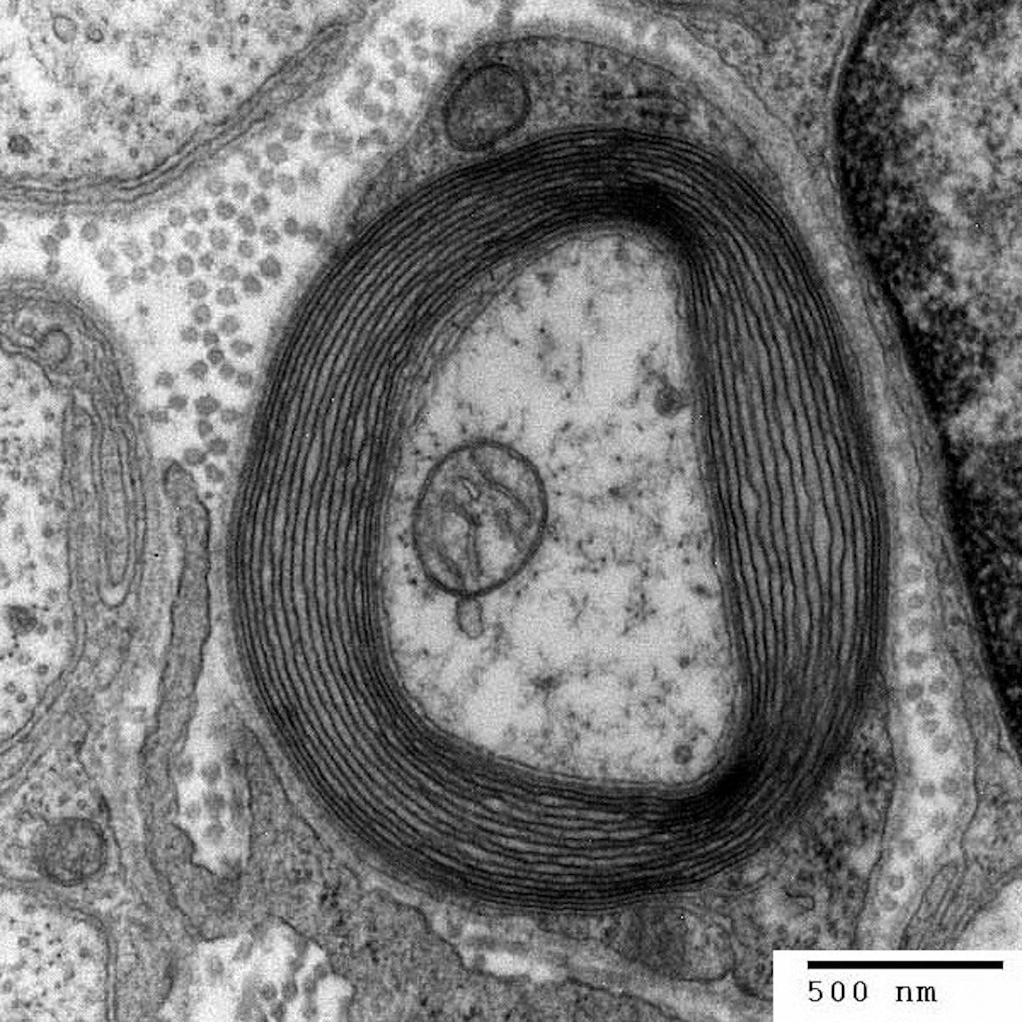 A myelin sheath around an axon.&nbsp;