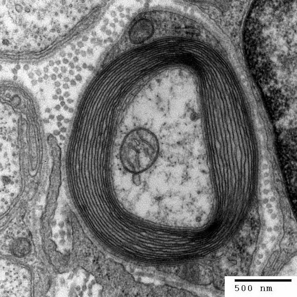 A myelin sheath around an axon.&nbsp;