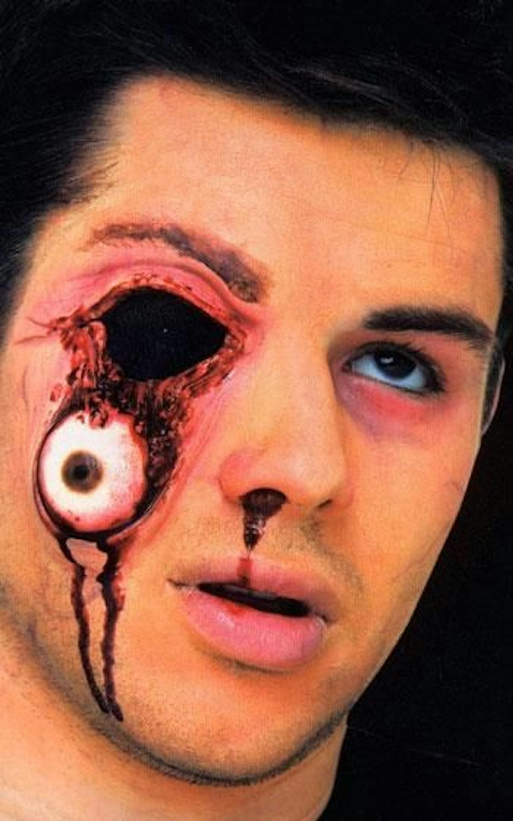 Eyeball hanging out of face