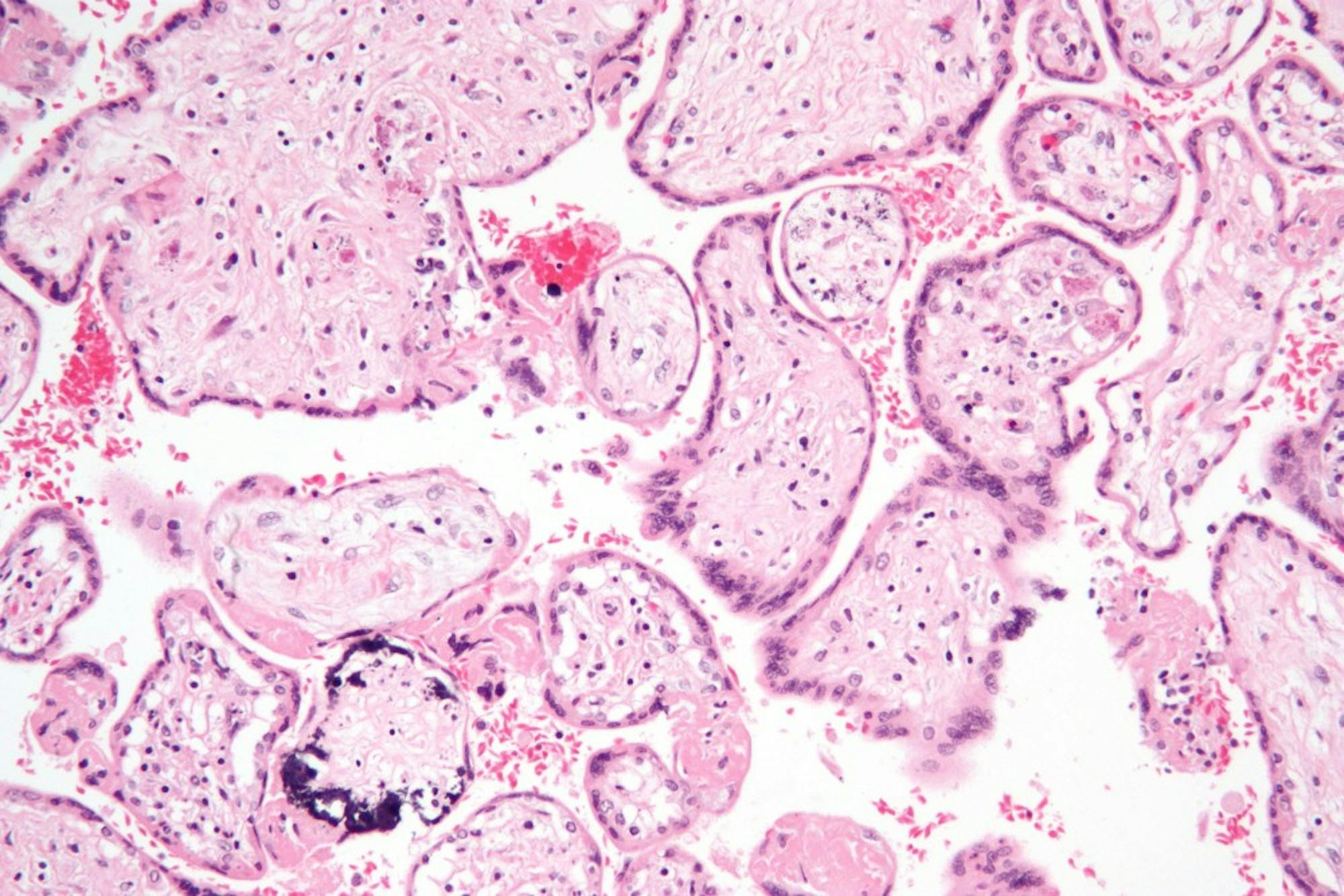 Human cytomegalovirus