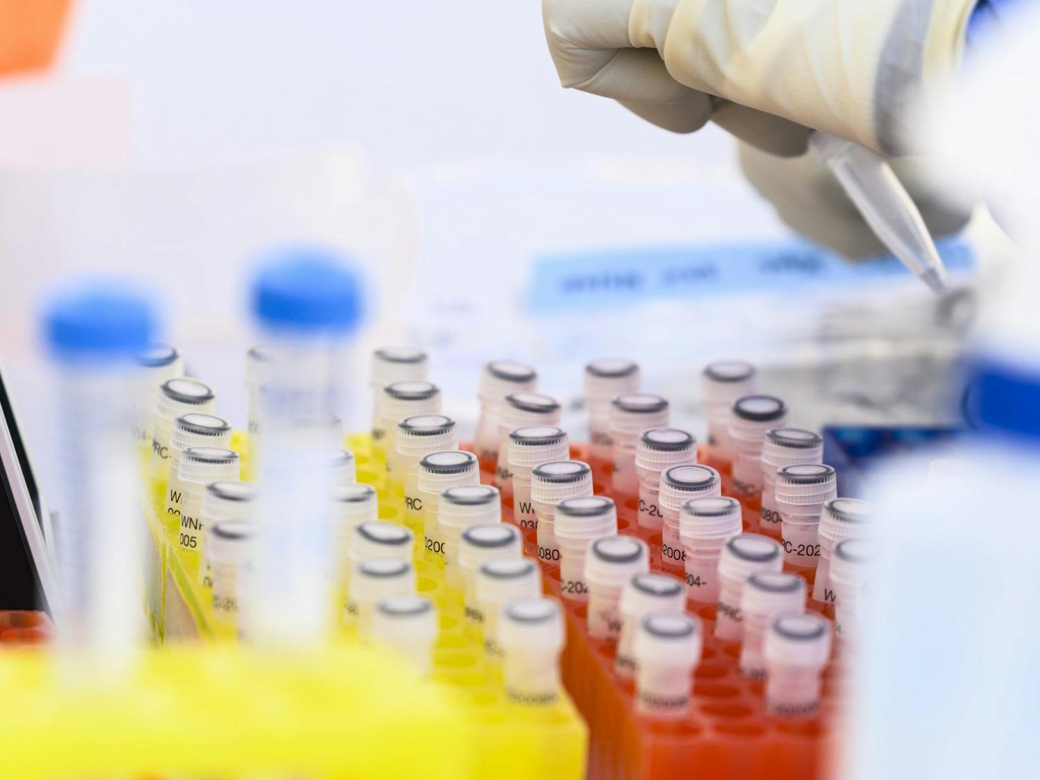 COVID-19_saliva_test20_8194