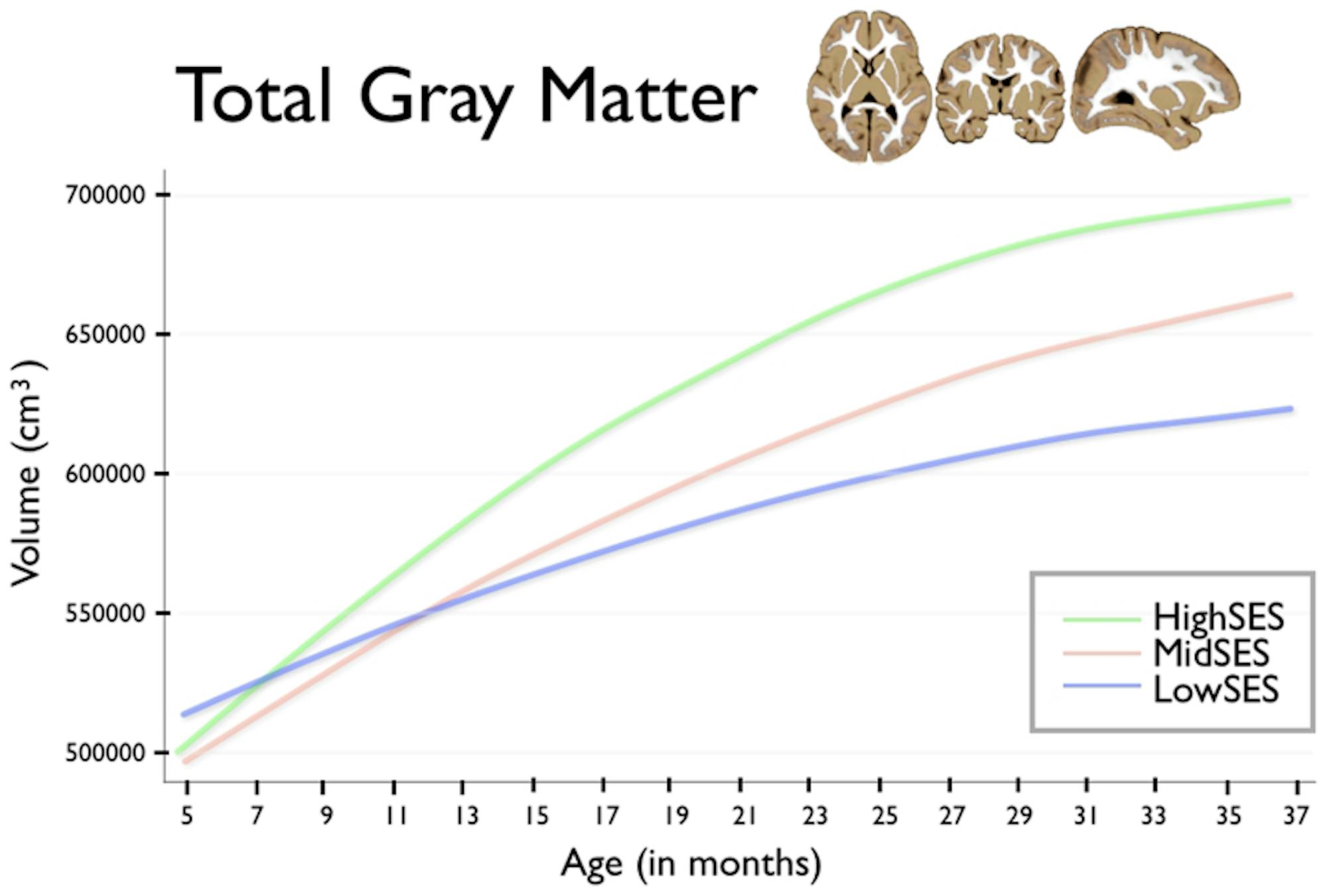 Total Gray Matter