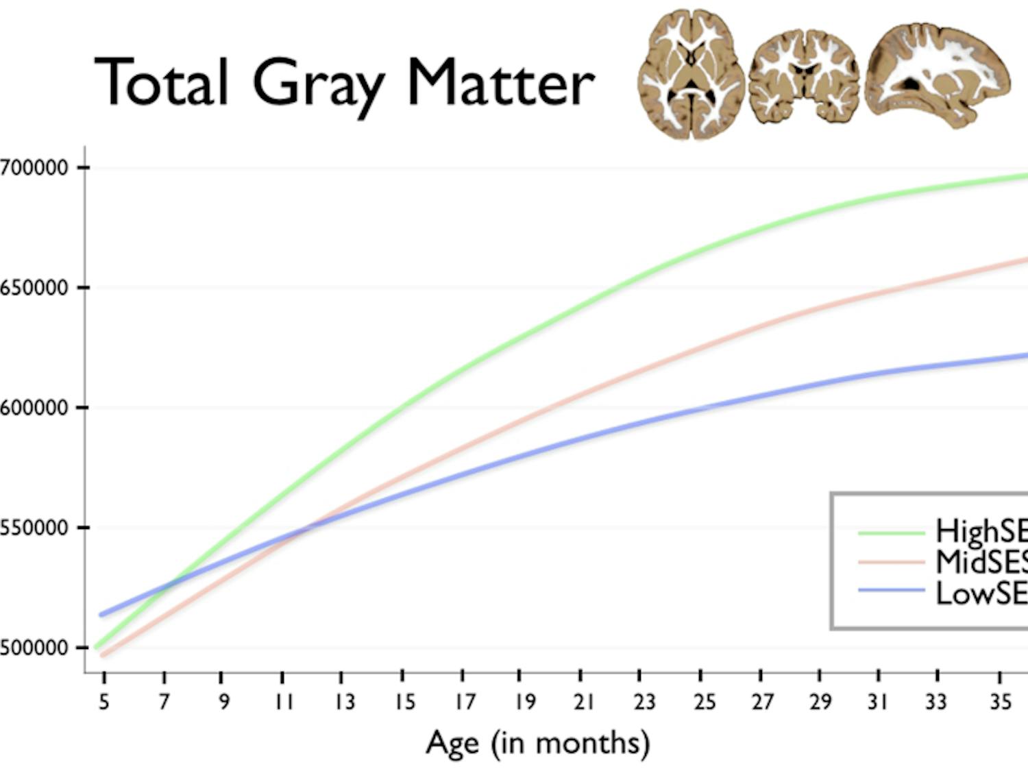 Total Gray Matter