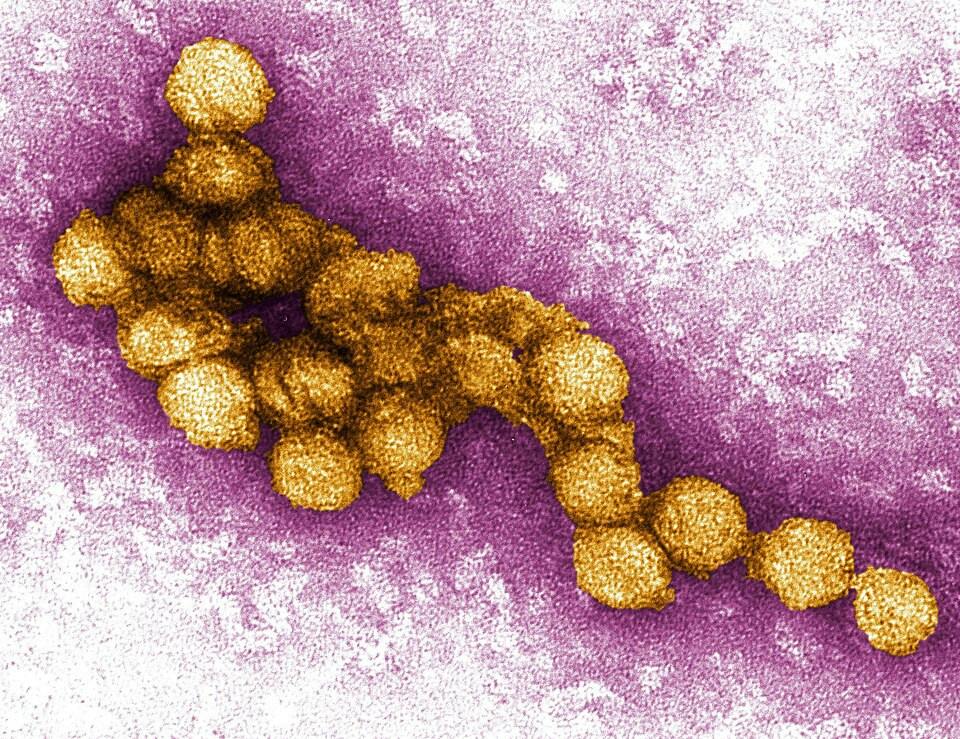 West_Nile_Virus_Image.jpg