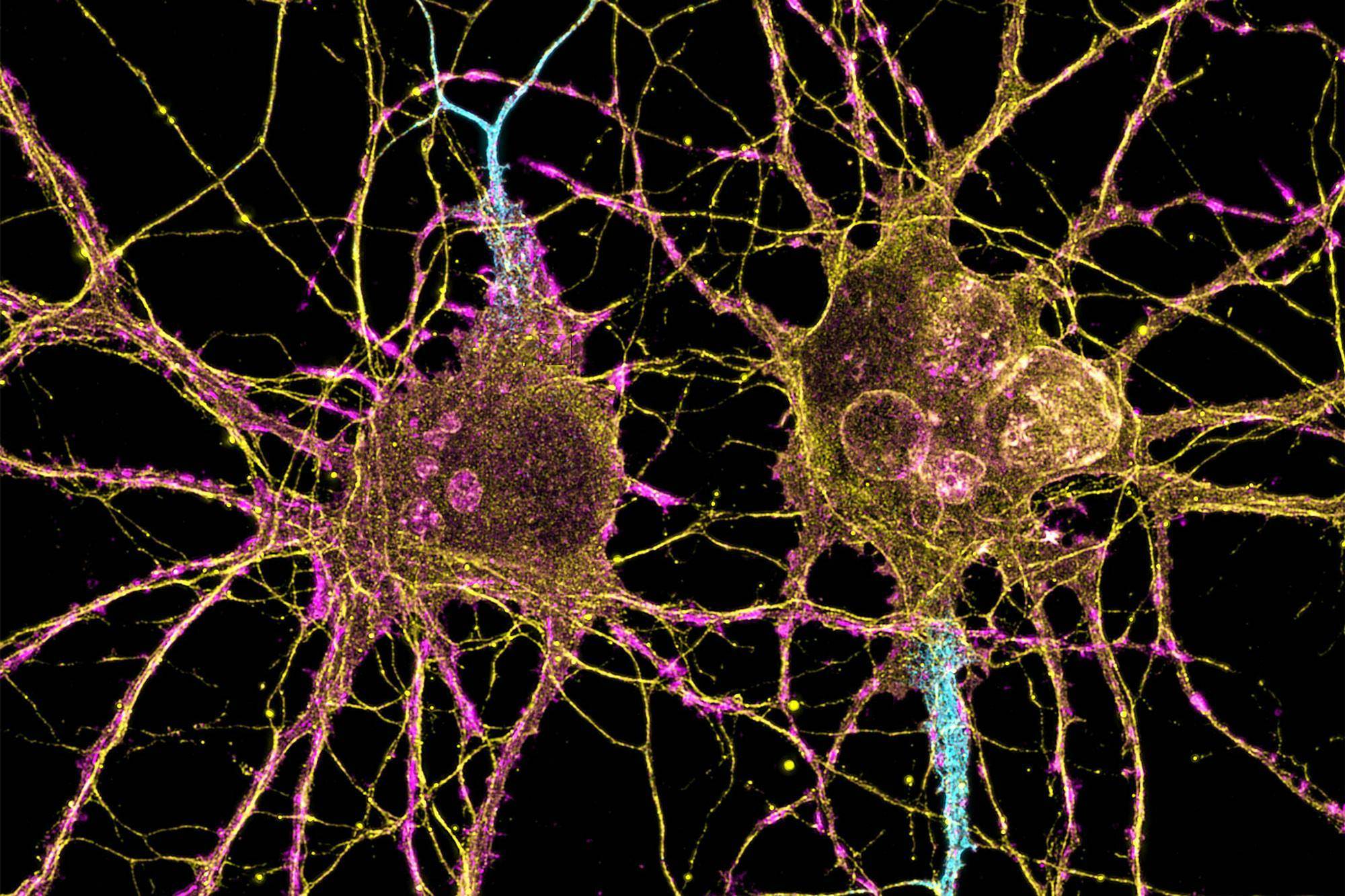 MIT-Huntingtons-Cells-01-press.jpg