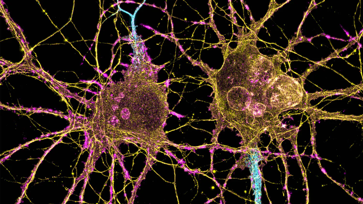 MIT-Huntingtons-Cells-01-press.jpg