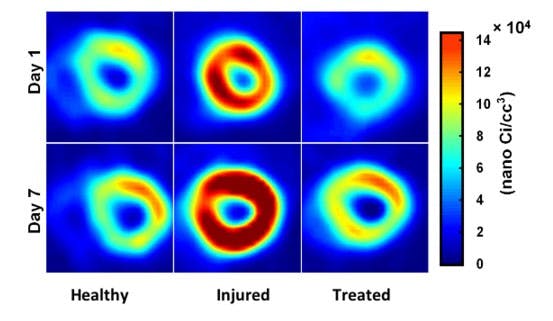 When injured, the heart begins taking in glucose, and becomes enlarged as depicted in the "Injured" heart slides.