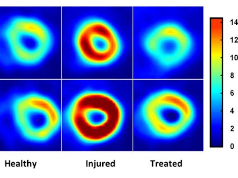 When injured, the heart begins taking in glucose, and becomes enlarged as depicted in the "Injured" heart slides.