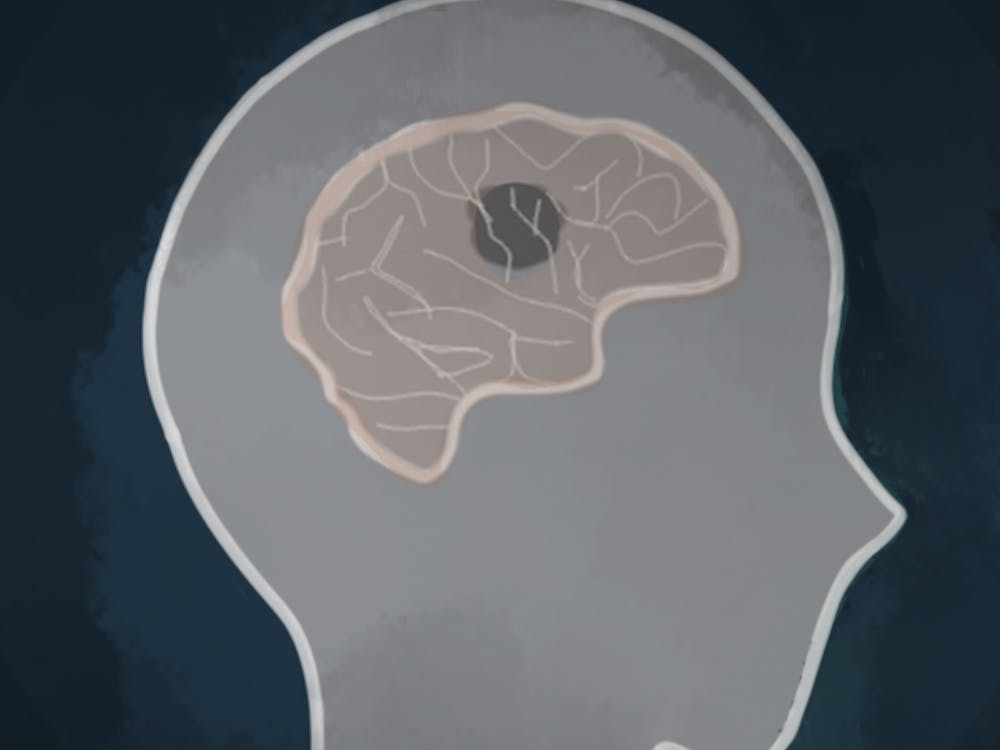 Cancer experts provide new knowledge on addressing brain metastases.