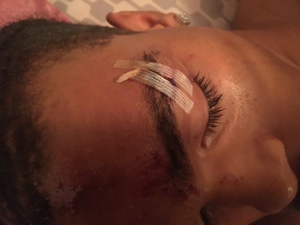 Deandre Harris was brutally attacked by a group of men in a downtown Charlottesville parking garage during the Aug. 12 &nbsp;“Unite the Right” rally. 
