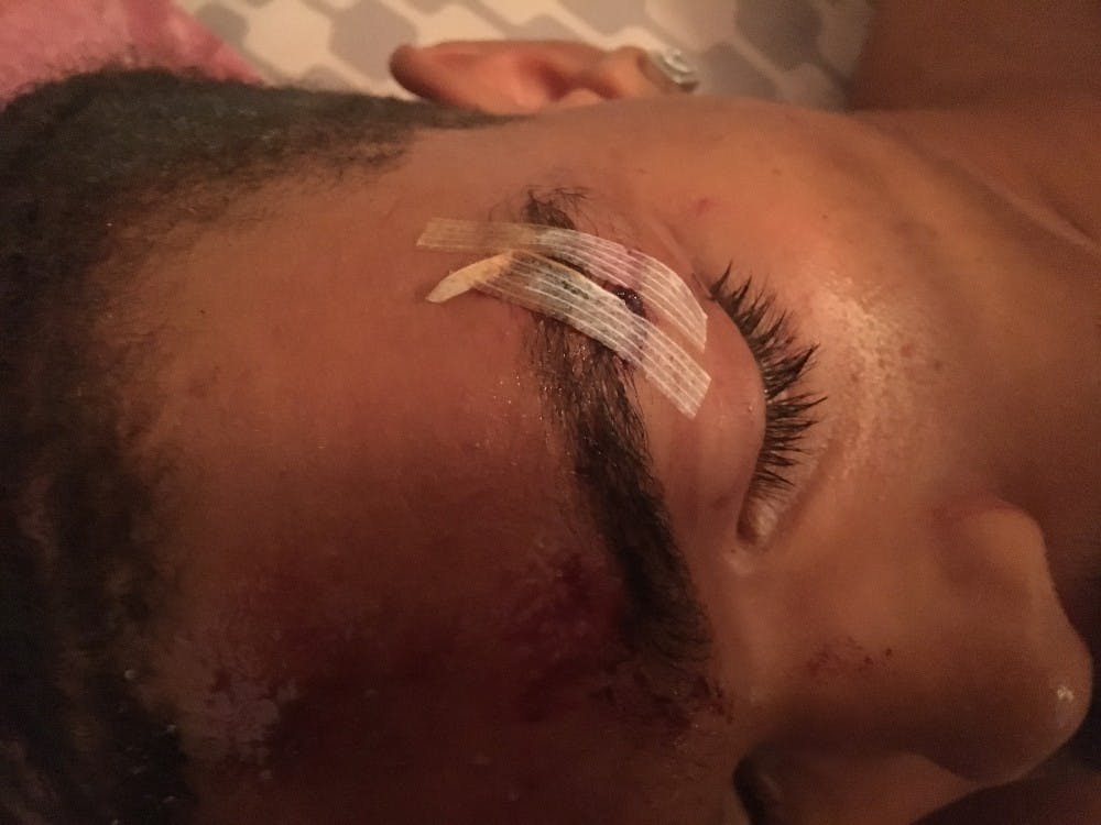 <p>Deandre Harris was brutally attacked by a group of men in a downtown Charlottesville parking garage during the Aug. 12 &nbsp;<a href="http://www.cavalierdaily.com/article/2017/08/unite-the-right-rally-protests-in-downtown-charlottesville-turns-deadly"><ins>“Unite the Right” rally</ins></a>. <br>
</p>
