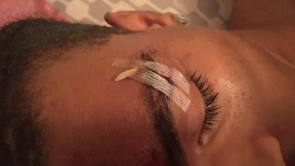 Deandre Harris was brutally attacked by a group of men in a downtown Charlottesville parking garage during the Aug. 12 &nbsp;“Unite the Right” rally. 
